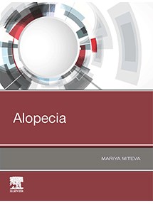 Livro Alopecia  Miteva