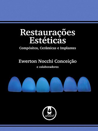 Livro Restauracoes Esteticas Compositos, Ceramicas e Implantes - Conceicao