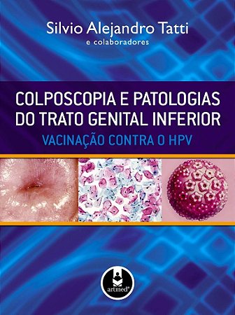 Livro Colposcopia e Patologias do Trato Genital Inferior