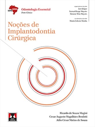 Livro Nocoes de Implantodontia Cirurgica - Magini/benfatti/souz