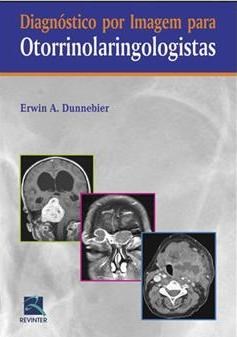 Livro Diagnostico por Imagem para Otorrinolaringologistas - Dunnebier