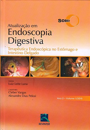 Livro Terapêutica Endoscópica Estômago e Intestino Delgado SOBED