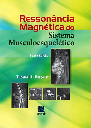 Livro Rm do Sistema Musculoesqueletico - Berquist