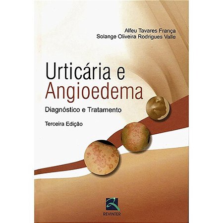 Livro Urticaria e Angioedema - Diagnostico e Tratamento - Franca/valle