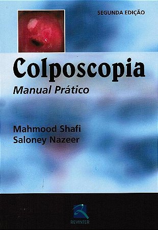 Livro Colposcopia Manual Prático