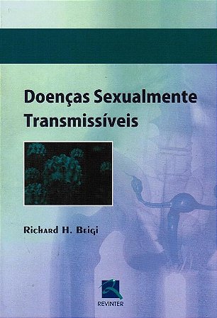 Livro Doencas Sexualmente Transmissiveis - Beigi