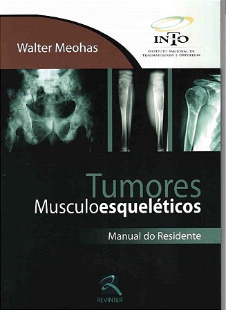 Livro Tumores Musculoesqueléticos  Meohas