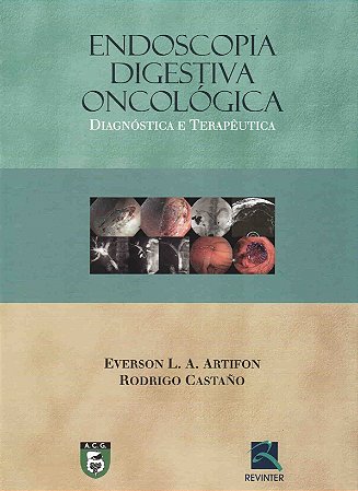 Livro Endoscopia Digestiva Oncológica