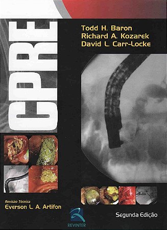 Livro Cpre - Colangiopancreatografia Retrograda - Baron