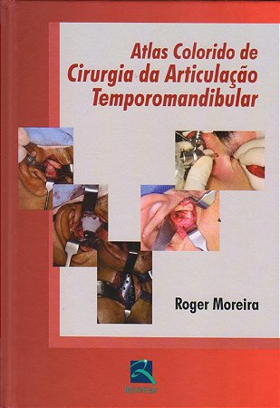 Livro Atlas Colorido de Cirurgia da Articulação Temporomandibular