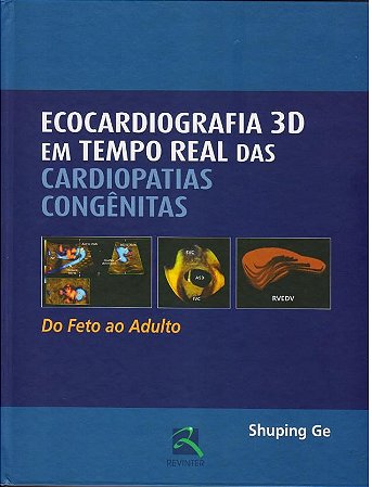 Livro Ecocardiografia 3d em Tempo Real das Cardiopatias Congenitas - do Feto ao A - Ge