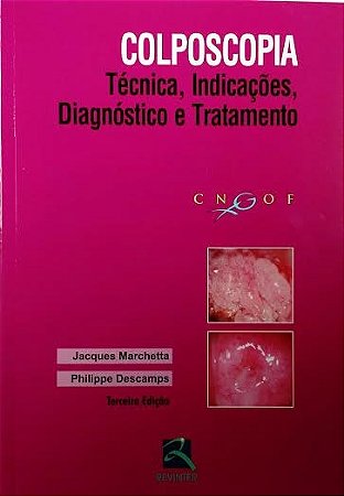 Livro Colposcopia Marchetta