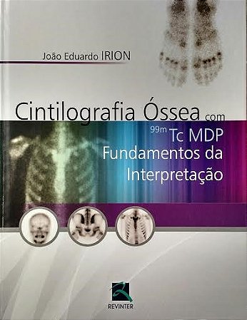 Livro Cintilografia Óssea com 99m TC MDP - Irion
