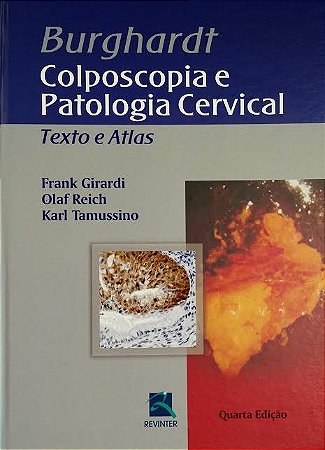 Livro Burghardt Colposcopia e Patologia Cervical - Girardi