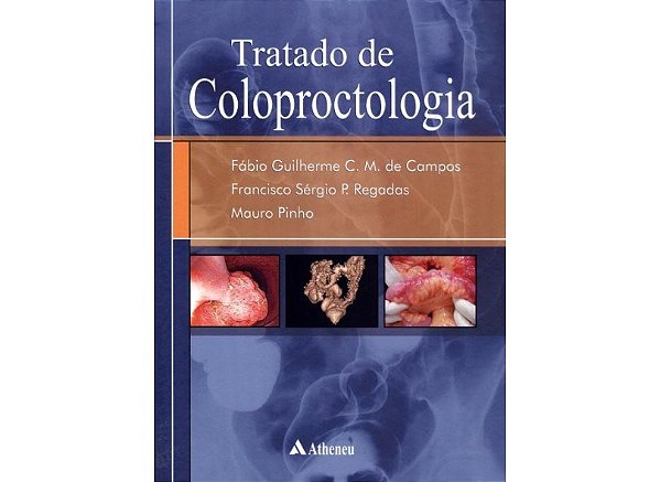 Livro Tratado de Coloproctologia