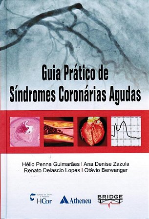 Livro Guia Pratico de Sindromes Coronarias Agudas - Guimaraes/zazula/lop