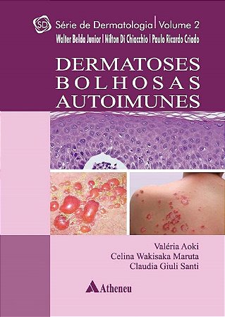 Livro Dermatose Bolhosas Autoimunes Vol. 2