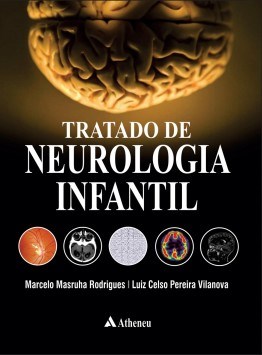 Livro Tratado de Neurologia Infantil