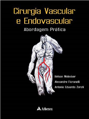 Livro Cirurgia Vascular e Endovascular - Wolosker