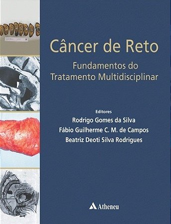 Livro Câncer de Reto