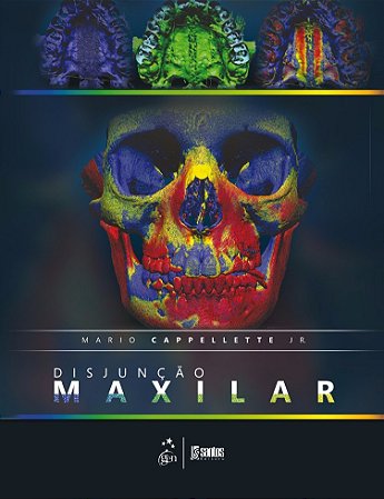 Livro Disjuncao Maxilar - Cappellette Jr.