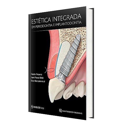 Livro Estética Integrada em Periodontia e Implantodontia - Frizzera - Napoleão