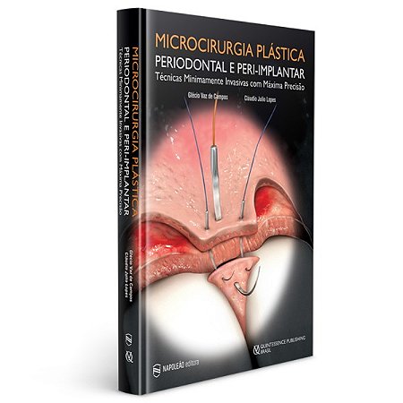 Livro Microcirurgia Plástica Periodontal e Peri-implantar Técnicas Minimamente Invasivas