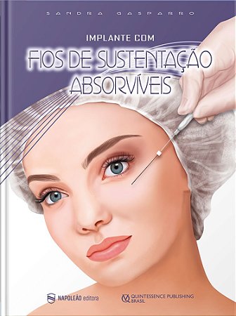 Livro Implante com Fios de Sustentacao Absorviveis - Gasparro