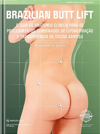 Livro Brazilian Butt Lift: o Guia de Anatomia Clinica para os Procedimentos Combi - Souza