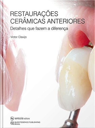 Livro Restauracoes Ceramicas Anteriores: Detalhes Que Fazem a Diferenca - Clavijo