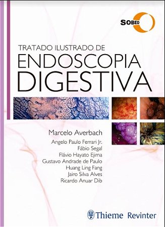 Livro Tratado Ilustrado de Endoscopia Digestiva SOBED