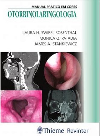 Livro Otorrinolaringologia - Manual Pratico em Cores - Patadia/rosenthal