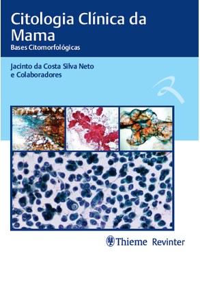 Livro Citologia Clínica da Mama - Silva Neto