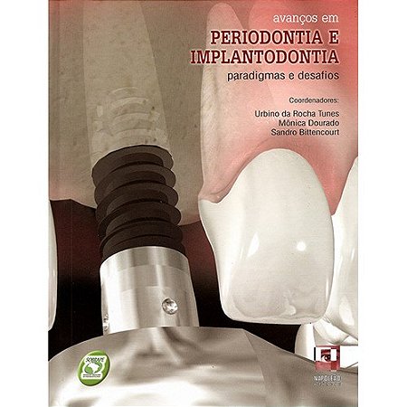Livro Avanços em Periodontia e Implantodontia - Tunes - Napoleão
