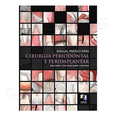 Livro Manual Pratico de Cirurgia Periodontal e Periimplantar - Cimoes