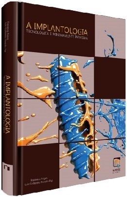 Livro Implantologia Tecnologica e Minimamente Invasiva, A - Nigro