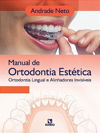 Livro Manual de Ortodontia Estetica - Ortodontia Lingual e Alinhadores Invisiveis - Neto