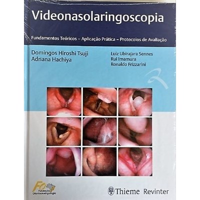 Livro Videonasolaringoscopia Fundamentos Teóricos - Tsuji - Revinter