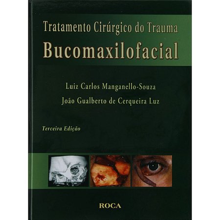 Livro Tratamento Cirurgico do Trauma Bucomaxilofacial - Cerqueira