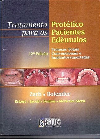 Livro Tratamento Protético para os Pacientes Edentulos - Zarb - Santos