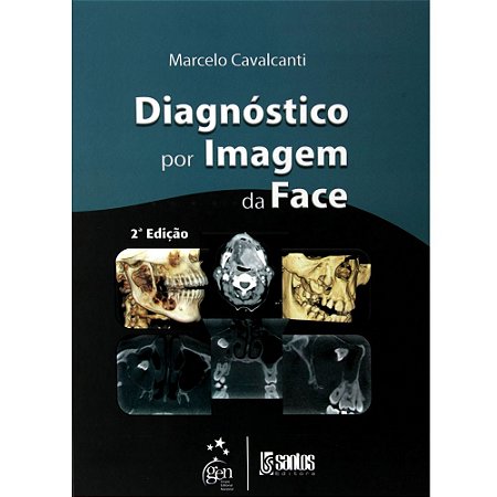 Livro Diagnóstico por Imagem da Face: Cavalcanti