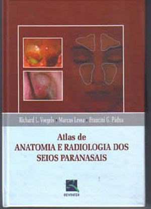 Livro Atlas de Anatomia e Radiologia dos Seios Paranasais