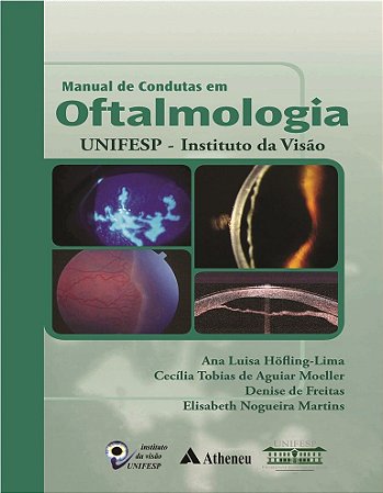 Livro Manual de Condutas em Oftalmologia - Diversos