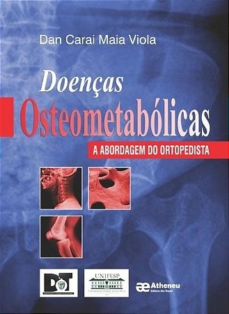 Livro Doencas Osteometabolicas - Viola