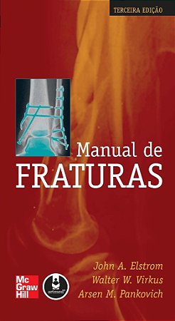 Livro Manual de Fraturas - Elstrom