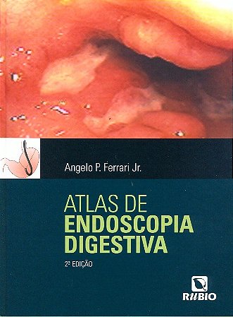 Livro Atlas de Endoscopia Digestiva