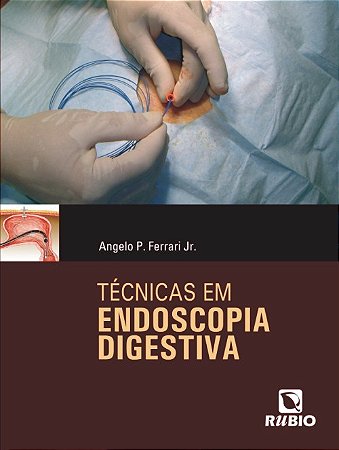 Livro Técnicas em Endoscopia Digestiva - Ferrari - Rúbio