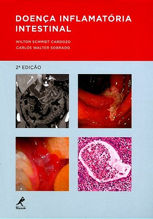 Livro Doença Inflamatória Intestinal - Cardozo - Manole