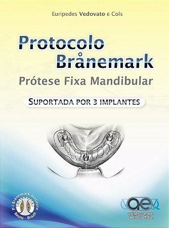 Livro Protocolo Branemark