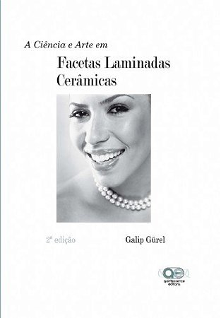 Livro Ciencia e Arte em Facetas Laminadas Ceramicas, A - Gurel